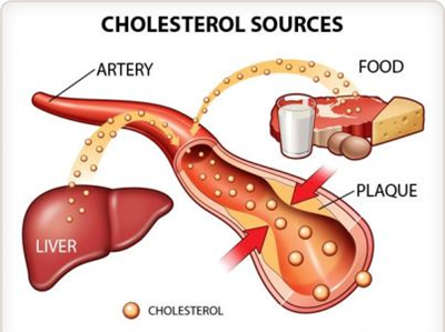 cholesterol400.jpg